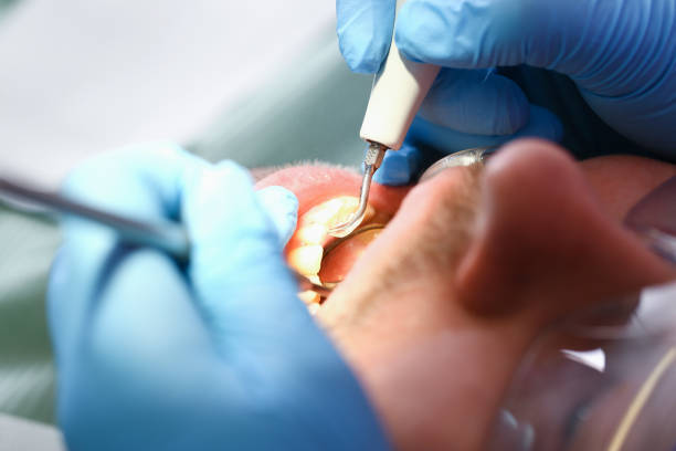 Best Emergency Care for Gum Disease in Mount Pleasant, NC